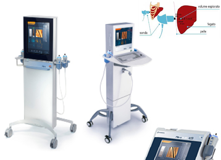fegato-fibroscan.jpg